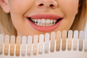 How Veneers Can Improve Light Reflection for a More Youthful Appearance